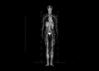 Whole-Body MRI Cancer Screening