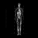 Whole-Body MRI Cancer Screening