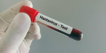 Hantavirus Cruise Ship Outbreak