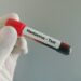 Hantavirus Cruise Ship Outbreak